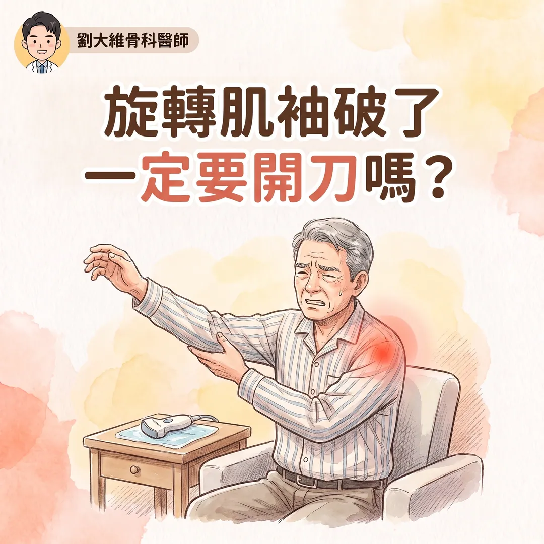 旋轉肌袖撕裂：什麼時候該開刀？PRP 到底有沒有效？
