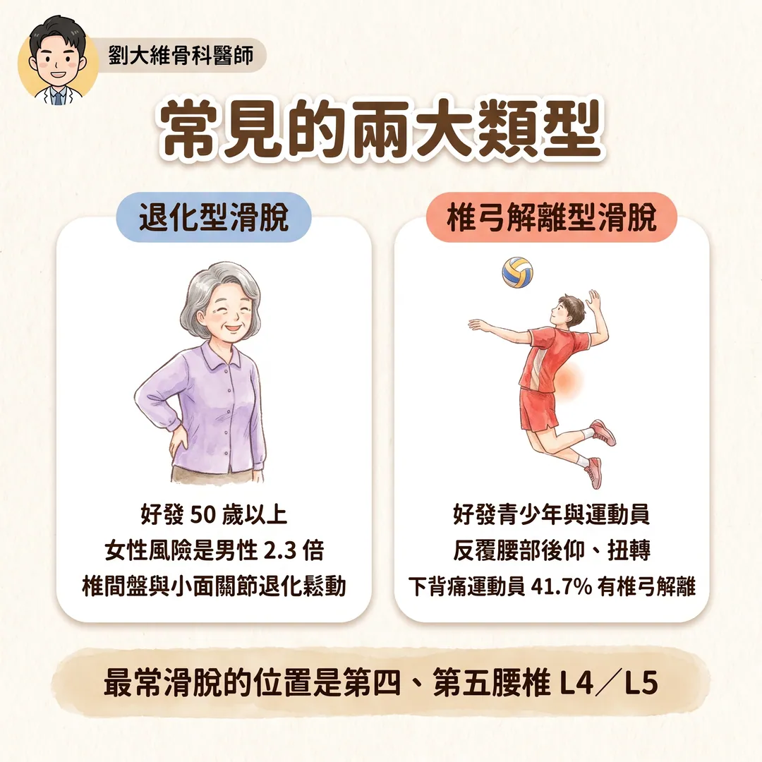 腰椎滑脫症是什麼？為什麼站久走久就腰痠腿麻？醫師教你怎麼預防 衛教圖 3