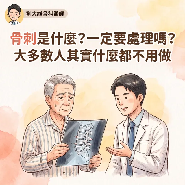骨刺是什麼？一定要處理嗎？骨科醫師告訴你