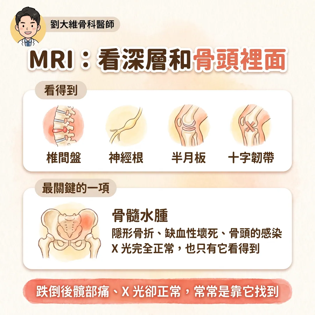 骨科影像金三角：X 光、超音波、MRI 各自看什麼、優缺點 衛教圖 5