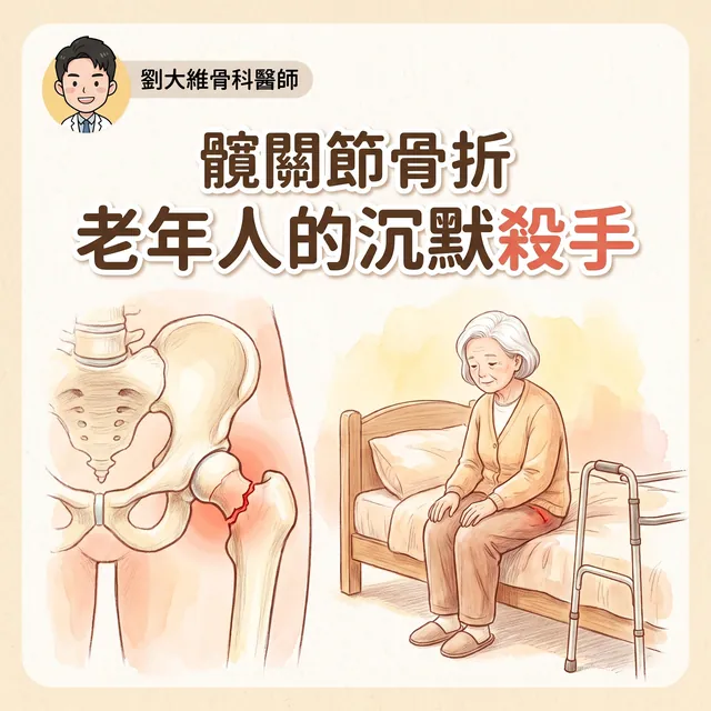 髖關節骨折：老年人殺手