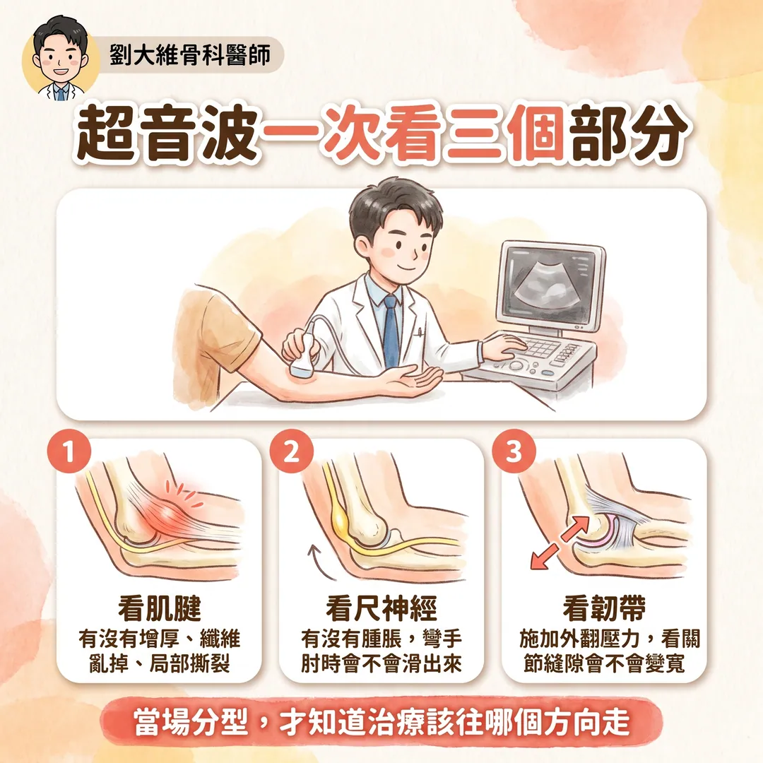 高爾夫球肘（內上髁肌腱病變）：為什麼比網球肘難治 衛教圖 8